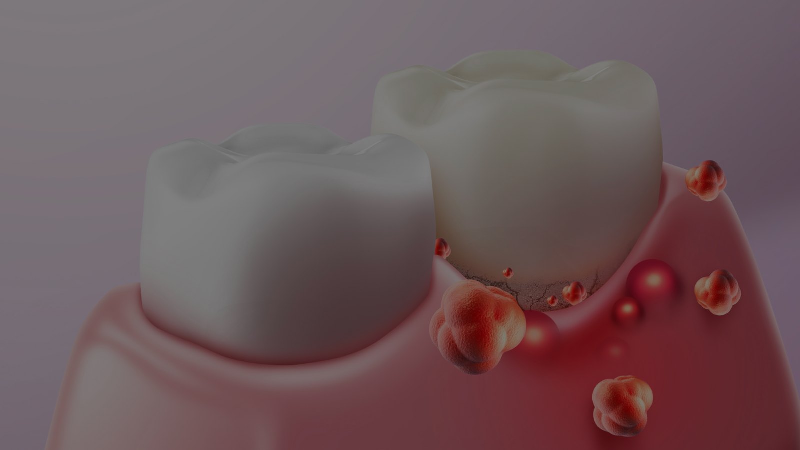 치아 사이 붉은 잇몸에 핏방울이 맺힌 모습을 표현한 3D 그림